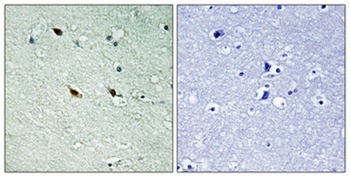 NIFK (phospho Thr234) rabbit pAb Antibody