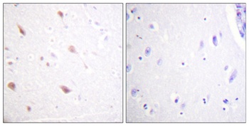 NIFK (phospho Thr234) rabbit pAb Antibody
