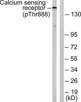 CaSR (phospho Thr888) rabbit pAb Antibody