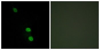 TEF-4 rabbit pAb Antibody