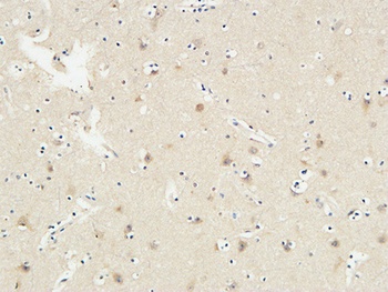 KiSS-1R rabbit pAb Antibody