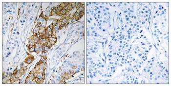 USP32 rabbit pAb Antibody