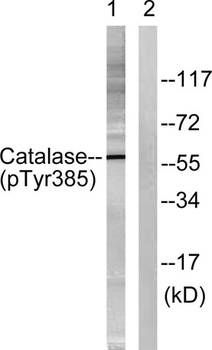 Catalase (phospho Tyr386) rabbit pAb Antibody