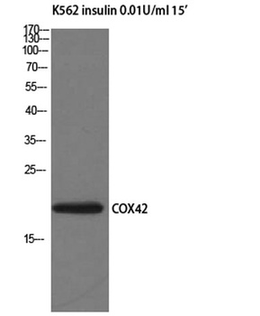 COX4I2 rabbit pAb Antibody
