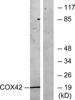 COX4I2 rabbit pAb Antibody