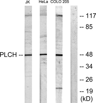 LPAAT-θ rabbit pAb Antibody