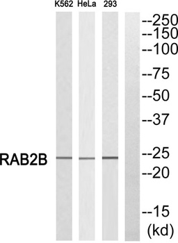 Rab 2B rabbit pAb Antibody