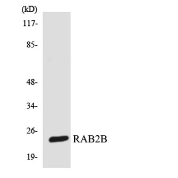 Rab 2B rabbit pAb Antibody