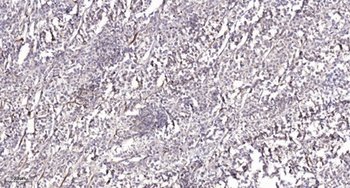 REPS1 rabbit pAb Antibody