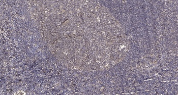 IKKγ (phospho Ser85) rabbit pAb Antibody