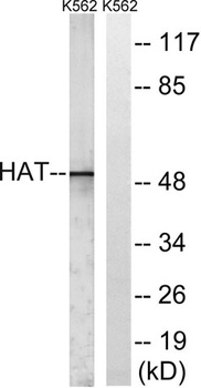 HAT1 rabbit pAb Antibody