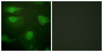 CaMKIα (phospho Thr177) rabbit pAb Antibody