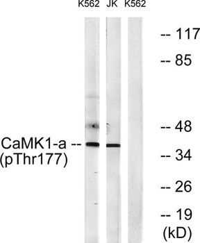 CaMKIα (phospho Thr177) rabbit pAb Antibody