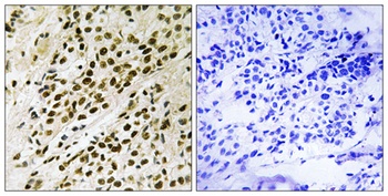PRAK (phospho Thr182) rabbit pAb Antibody