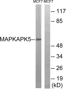 PRAK rabbit pAb Antibody