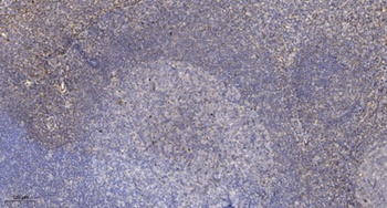 PRAK rabbit pAb Antibody