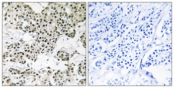 FMIP rabbit pAb Antibody