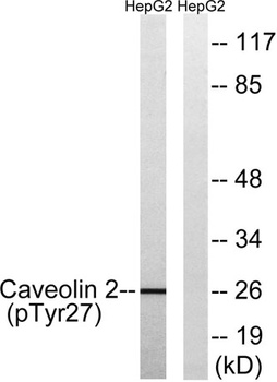 Caveolin-2 (phospho Tyr27) rabbit pAb Antibody
