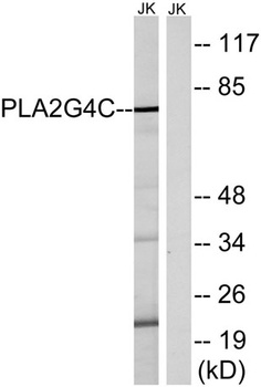 cPLA2-γ rabbit pAb Antibody