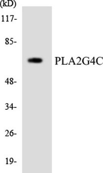 cPLA2-γ rabbit pAb Antibody