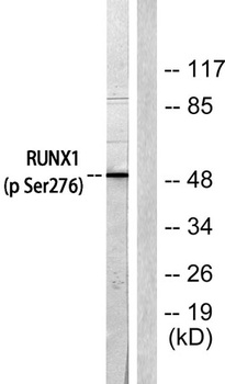 RUNX1 (phospho Ser276) rabbit pAb Antibody