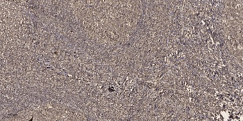 p63 rabbit pAb Antibody