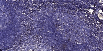 SerpinA6 rabbit pAb Antibody