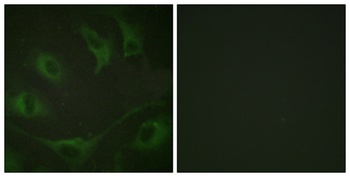 Cbl (phospho Tyr774) rabbit pAb Antibody