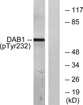 Dab1 (phospho Tyr232) rabbit pAb Antibody