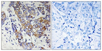 Carbonyl Reductase 1 rabbit pAb Antibody