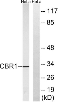 Carbonyl Reductase 1 rabbit pAb Antibody