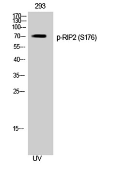 RIP2 (phospho Ser176) rabbit pAb