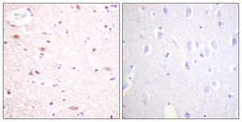 Cdc16 (phospho Ser560) rabbit pAb Antibody