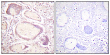 Cyclin B1 (phospho Ser147) rabbit pAb Antibody