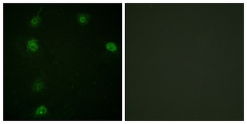 Cyclin E1 (phospho Thr77) rabbit pAb Antibody