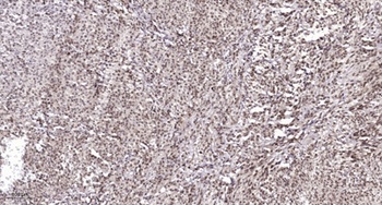 Cyclin E1 (phospho Thr77) rabbit pAb Antibody