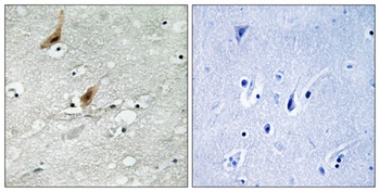 MSK2 (phospho Thr568) rabbit pAb Antibody