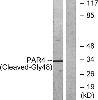 Cleaved-PAR-4 (G48) rabbit pAb Antibody