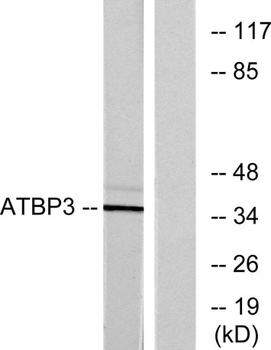 ATPBD3 rabbit pAb Antibody