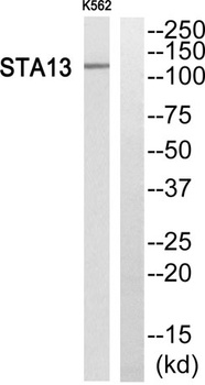 StARD13 rabbit pAb Antibody