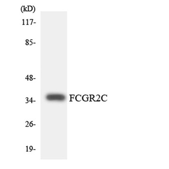CD32-C rabbit pAb Antibody