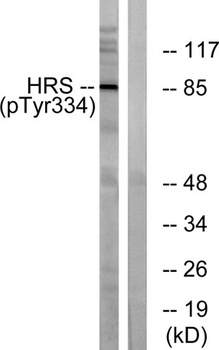 Hrs (phospho Tyr334) rabbit pAb Antibody