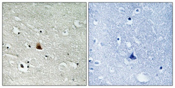 Nek9 (phospho Thr210) rabbit pAb Antibody