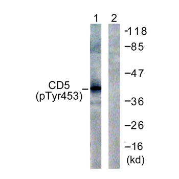 CD5 (phospho Tyr453) rabbit pAb