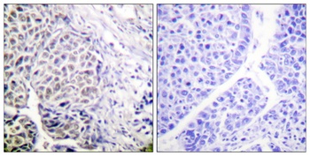 ARK-2 (phospho Tyr12) rabbit pAb Antibody