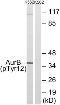 ARK-2 (phospho Tyr12) rabbit pAb Antibody