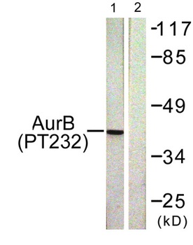 ARK-2 (phospho Thr232) rabbit pAb Antibody