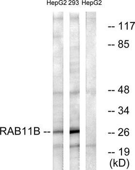Rab 11B rabbit pAb Antibody