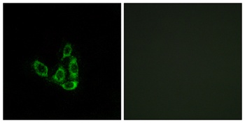 GCNT3 rabbit pAb Antibody