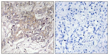 GCNT3 rabbit pAb Antibody